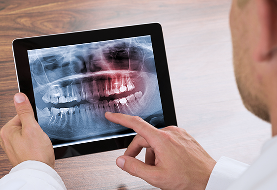 Person examining dental X-ray tablet