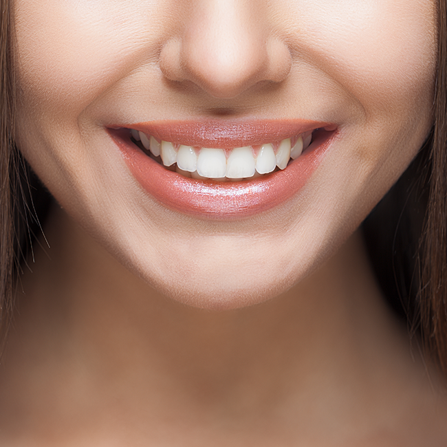 Smile with bright white teeth