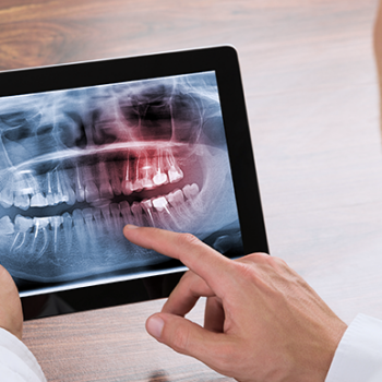 Person examining dental X-ray tablet